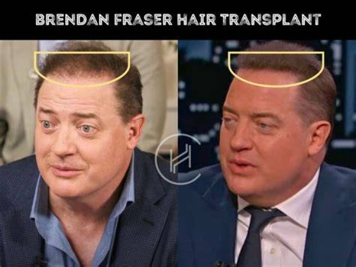 
Brendan Fraser Crying Meme Explained: In Which Scene Did He Cry? 