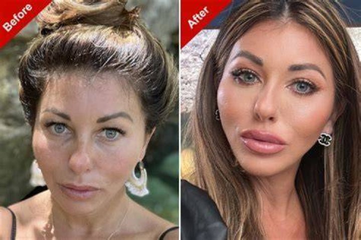 Did Holly Sonders Have Plastic Surgery Done? Fans Are Curious About The Golfer As She Gets More Popular