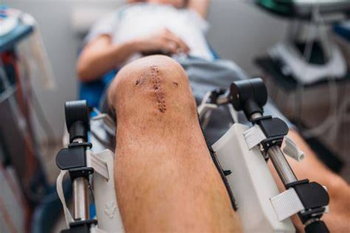 
Is Roger Federer Retired After Australian Open? Knee Surgery and Operation Update 